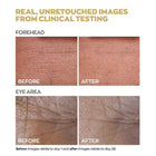 Anew Reversalist Mini Gift Set